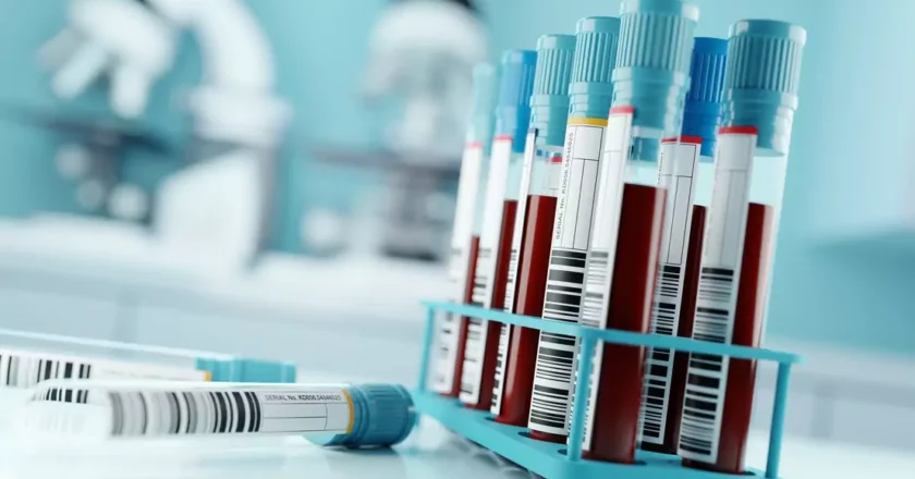 Avance médico: análisis de sangre detecta el Alzheimer con 95% de precisión